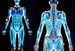 Fibromiyalji nedir? Nedenleri ve tedavisi hakkında bilgi