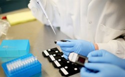 kanserin erken teşhisinde başvurulacak 12 test