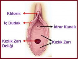 Kızlık zarı (Hymen) nedir nasıl dikilir?