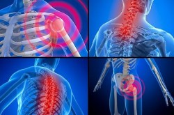 Fibromiyalji nedir, nedenleri ve tedavisi Fibromiyalji nedir, nedenleri ve tedavisi