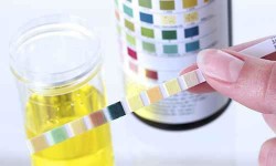 idrarda protein nasıl azaltılır