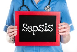 Sepsis Nedir Nasıl bulaşır Sepsis Tedavisi Sepsis Nedir Nasıl bulaşır Sepsis Tedavisi