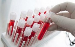 hemoglabin düşüklüğü