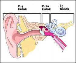 İç kulak iltihabı en yaygın belirtileri ve tedavisi İç kulak iltihabı en yaygın belirtileri ve tedavisi