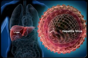 Hepatit belirtileri nasıl anlaşılır ve hepatit için alınacak önlemler