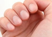 Tırnak diplerindeki beyazlıklar ne anlama geliyor Tırnak diplerindeki beyazlıklar ne anlama geliyor