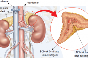 Addison hastalığı ve adrenal böbreküstü bezi hakkında