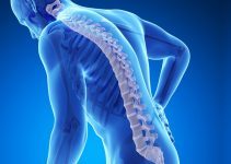Kemik erimesi Osteoporoz nedir, neden olur? Kemik erimesi Osteoporoz nedir, neden olur?