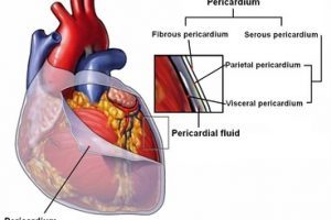 Perikardit (kalp zarı iltihabı) nedir, nedenleri, belirtileri ve tedavisi