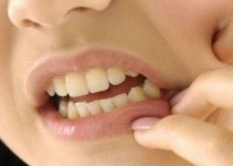 Aft (Ağız yarası) Nedenleri Nelerdir? Aft (Ağız yarası) Nedenleri Nelerdir?