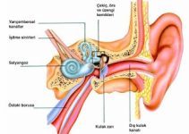 Meniere hastalığı nedir? Meniere belirtileri ve tedavisi Meniere hastalığı nedir? Meniere belirtileri ve tedavisi