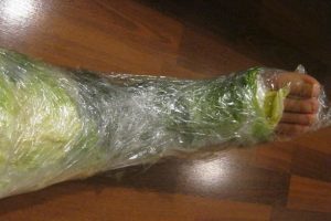 Lahana Kürü ile Eklem ağrısı nasıl geçer