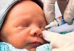 bebeklerde goz capaklanmasi neden olur nasil gecer poliklinik