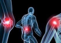 Kireçlenme (Osteoartrit) Nedir? Nedenleri ve Belirtileri Nelerdir? Kireçlenme (Osteoartrit) Nedir? Nedenleri ve Belirtileri Nelerdir?