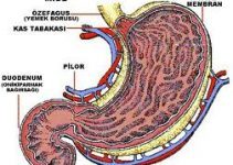 Ülser nedir? Belirtileri ve tedavisi nelerdir? Ülser nedir? Belirtileri ve tedavisi nelerdir?