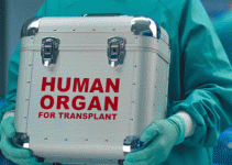Organ bağışı nedir merak edilenler Organ bağışı nedir merak edilenler
