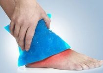 Ayak bileği şişmesi neden olur tedavisi nasıl yapılır? Ayak bileği şişmesi neden olur tedavisi nasıl yapılır?