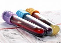 Hemogram (Tam Kan Sayımı Testi) nedir? Hemogram (Tam Kan Sayımı Testi) nedir?