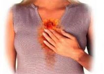 Yemek borusunda yanma nedenleri ve tedavisi Yemek borusunda yanma nedenleri ve tedavisi