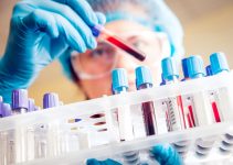 ASO Testi Nedir? Kanda ASO Yüksekliği ve Normal Değerleri ASO Testi Nedir? Kanda ASO Yüksekliği ve Normal Değerleri