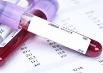 AST nedir? Yüksekliği ne anlama gelir? AST nedir? Yüksekliği ne anlama gelir?