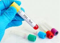 FSH nedir? Yüksekliği, düşüklüğü ve normal FSH değerleri FSH nedir? Yüksekliği, düşüklüğü ve normal FSH değerleri