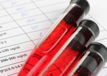 Ferritin nedir? Düşüklüğü ve yüksekliği ne anlama gelir?