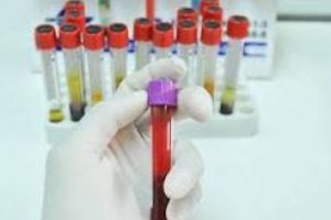 Troponin nedir? Yüksekliği düşüklüğü ve normal değerleri