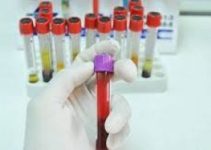 Troponin nedir? Yüksekliği düşüklüğü ve normal değerleri Troponin nedir? Yüksekliği düşüklüğü ve normal değerleri