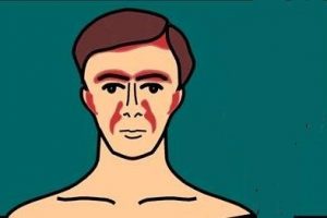 Seboreik dermatit nedir belirtileri ve tedavisi
