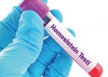 Homosistein Nedir? Bilmeniz Gereken Her Şey Homosistein Nedir? Bilmeniz Gereken Her Şey