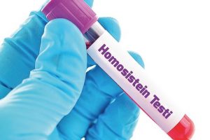 Homosistein Nedir? Bilmeniz Gereken Her Şey